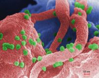 顯微鏡下的愛滋病病毒 Photo by CDC